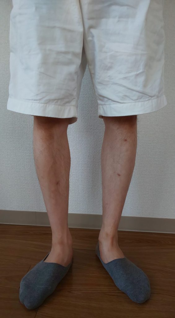 ショートパンツを少し下げて、膝の皿が隠れるようにして履いている写真